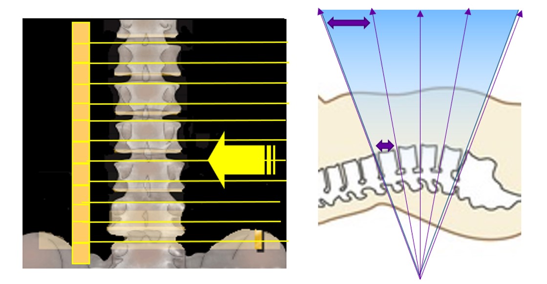 Technical Tips_detector array03.jpg